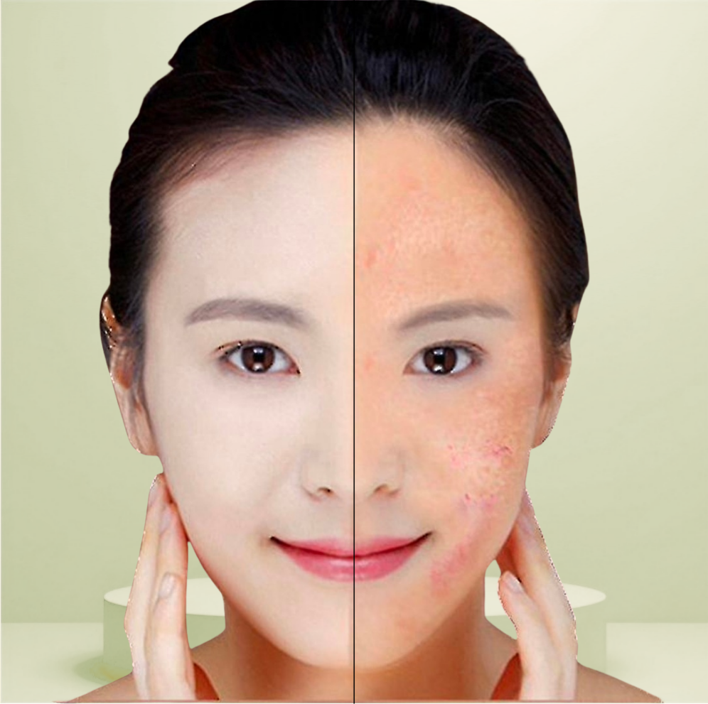 Rot- und Blaulichttherapiestift